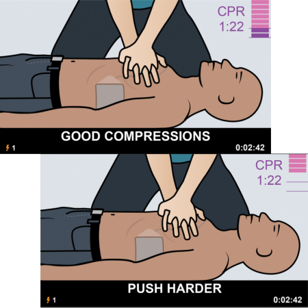Defibrillator ZOLL AED 3_Monitor
