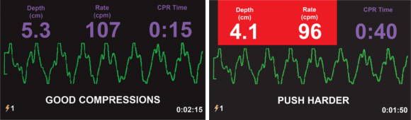 ZOLL AED 3 BLS_CPR Dashboard